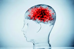 Brain-cancer